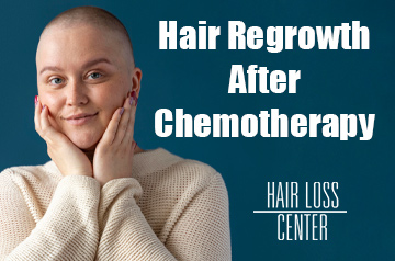 Hair Regrowth After Chemotherapy; Useful Tips and Insights 