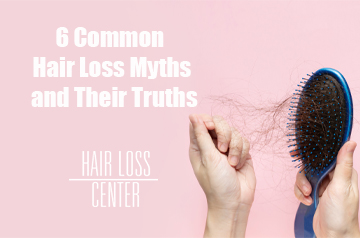 6 Common Hair Loss Myths and Their Truths: Separating Fact from Fiction 